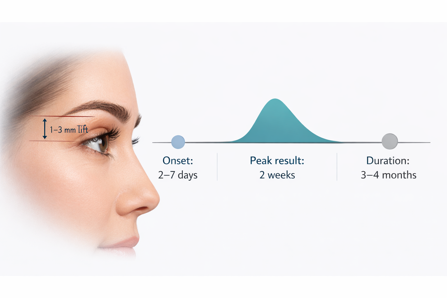 Infographic showing 1 to 3mm Botox brow lift elevation and timeline from onset to duration