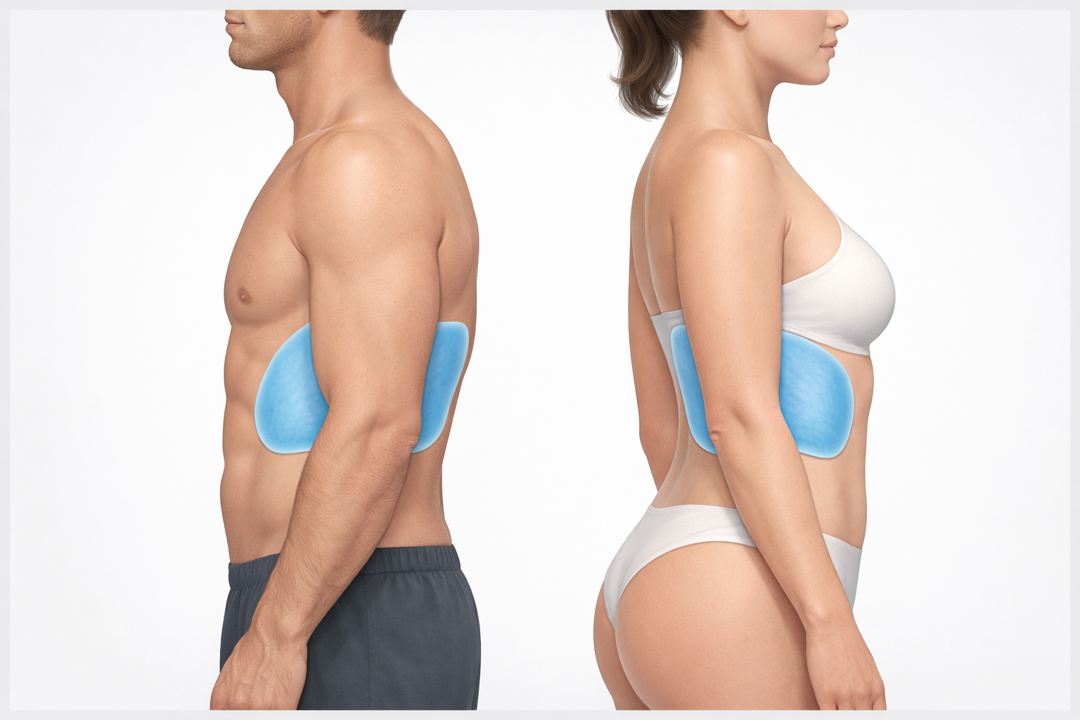 Illustration showing the love handle flank fat treatment zone targeted by CoolSculpting