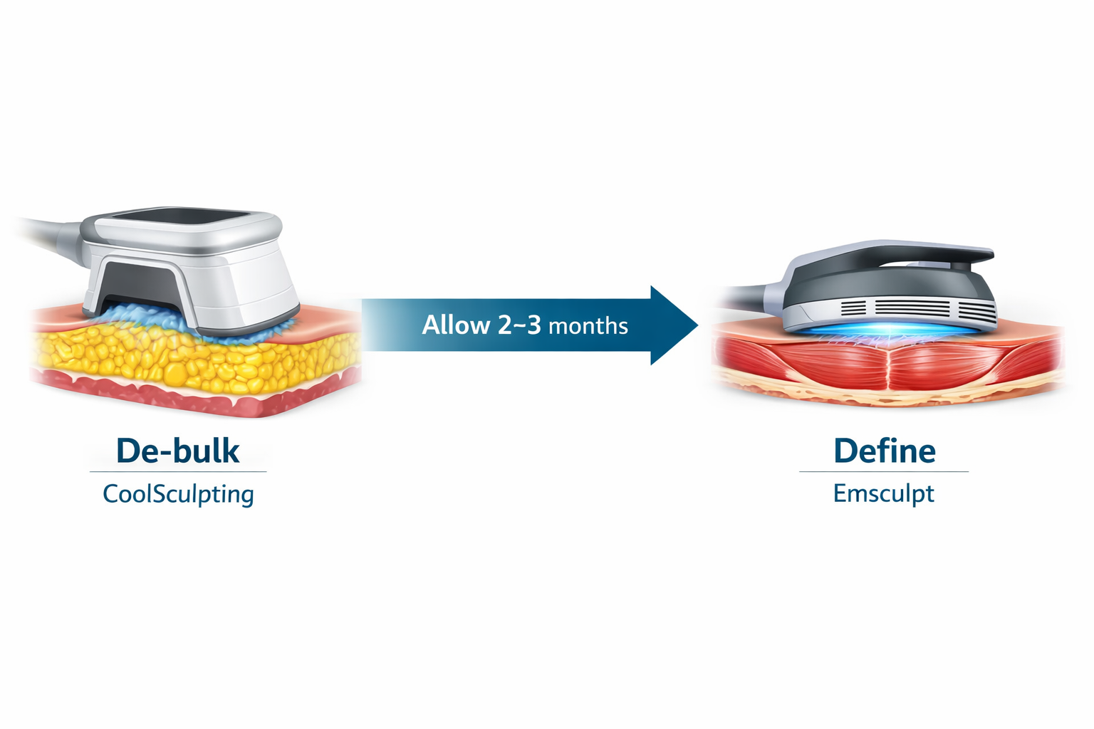 Three-step process diagram showing CoolSculpting followed by Emsculpt combination treatment sequence