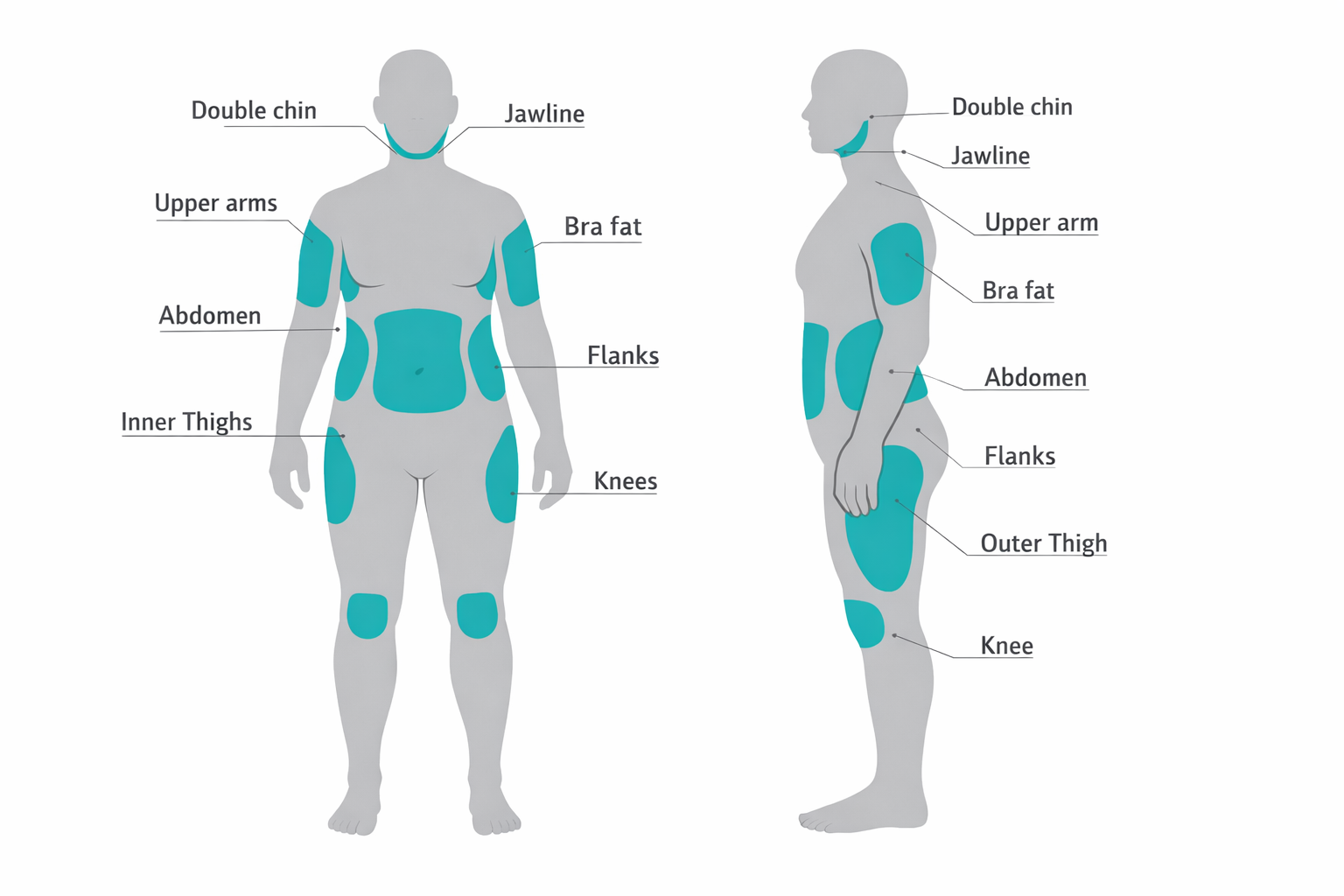 Body diagram showing fat dissolving injection and CoolSculpting treatment areas including chin