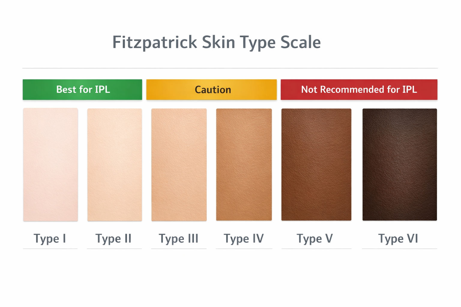 Fitzpatrick skin type scale chart showing IPL suitability from Type I to VI