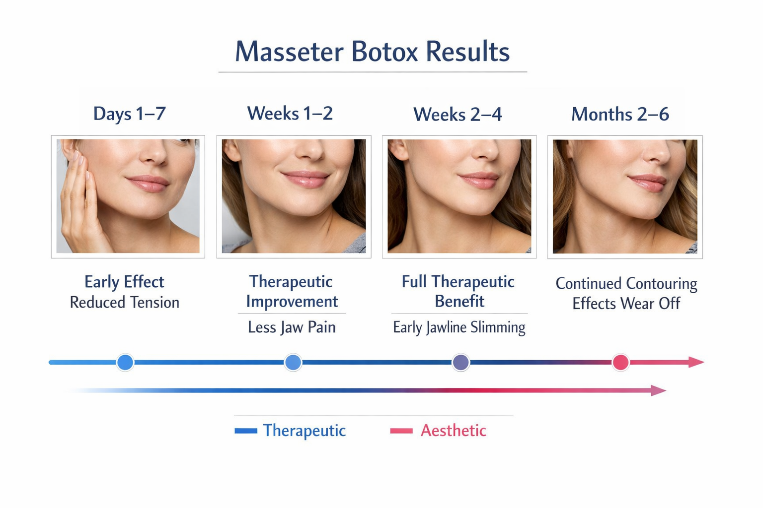 Timeline infographic showing masseter Botox therapeutic and aesthetic results by week and month