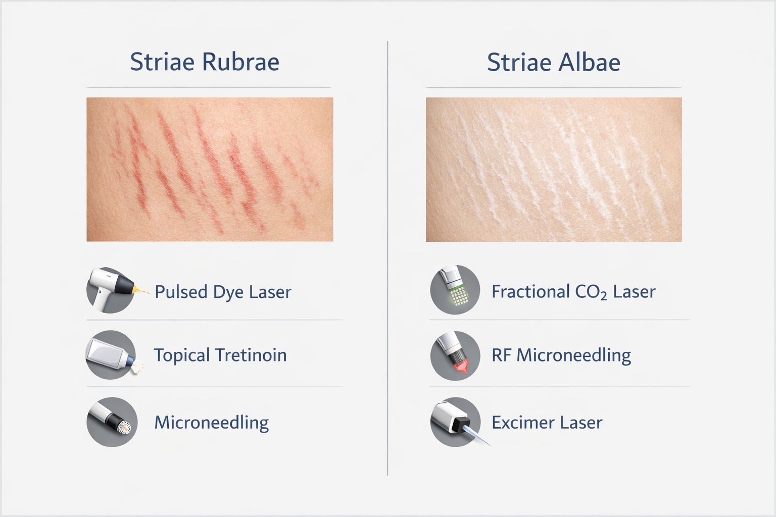 Comparison chart of treatments for red striae rubrae versus white striae albae stretch marks