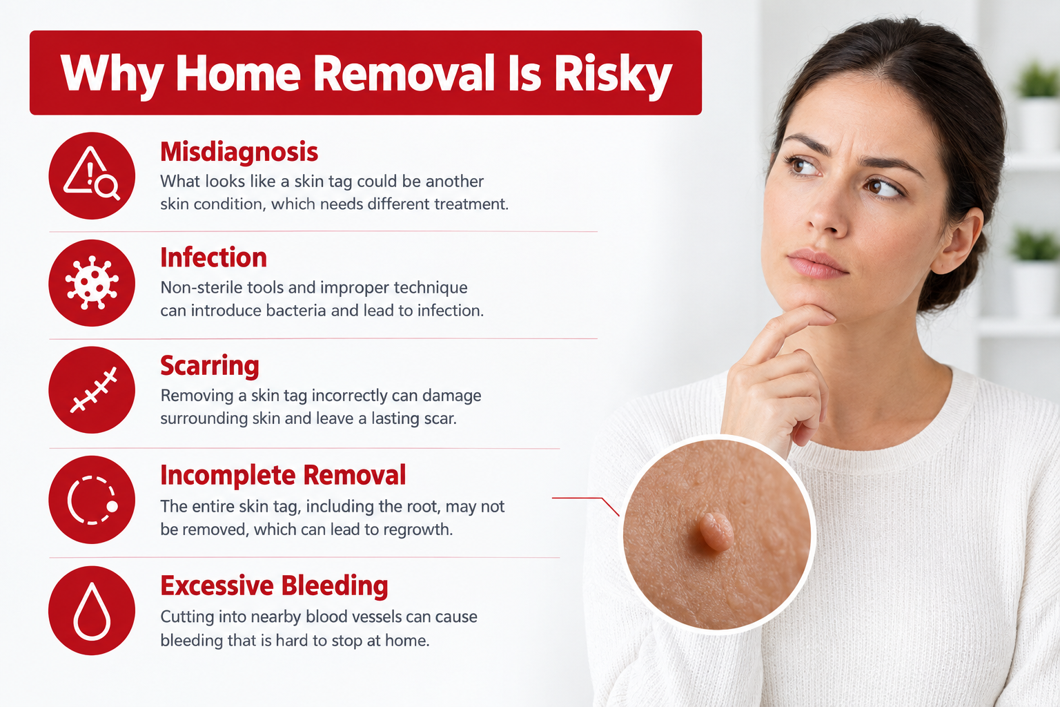 Infographic showing risks of home acrochordon removal including infection, scarring and misdiagnosis
