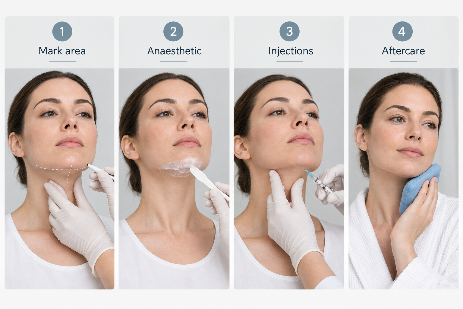 Four-step process of a chin fat dissolving injection appointment from marking to aftercare