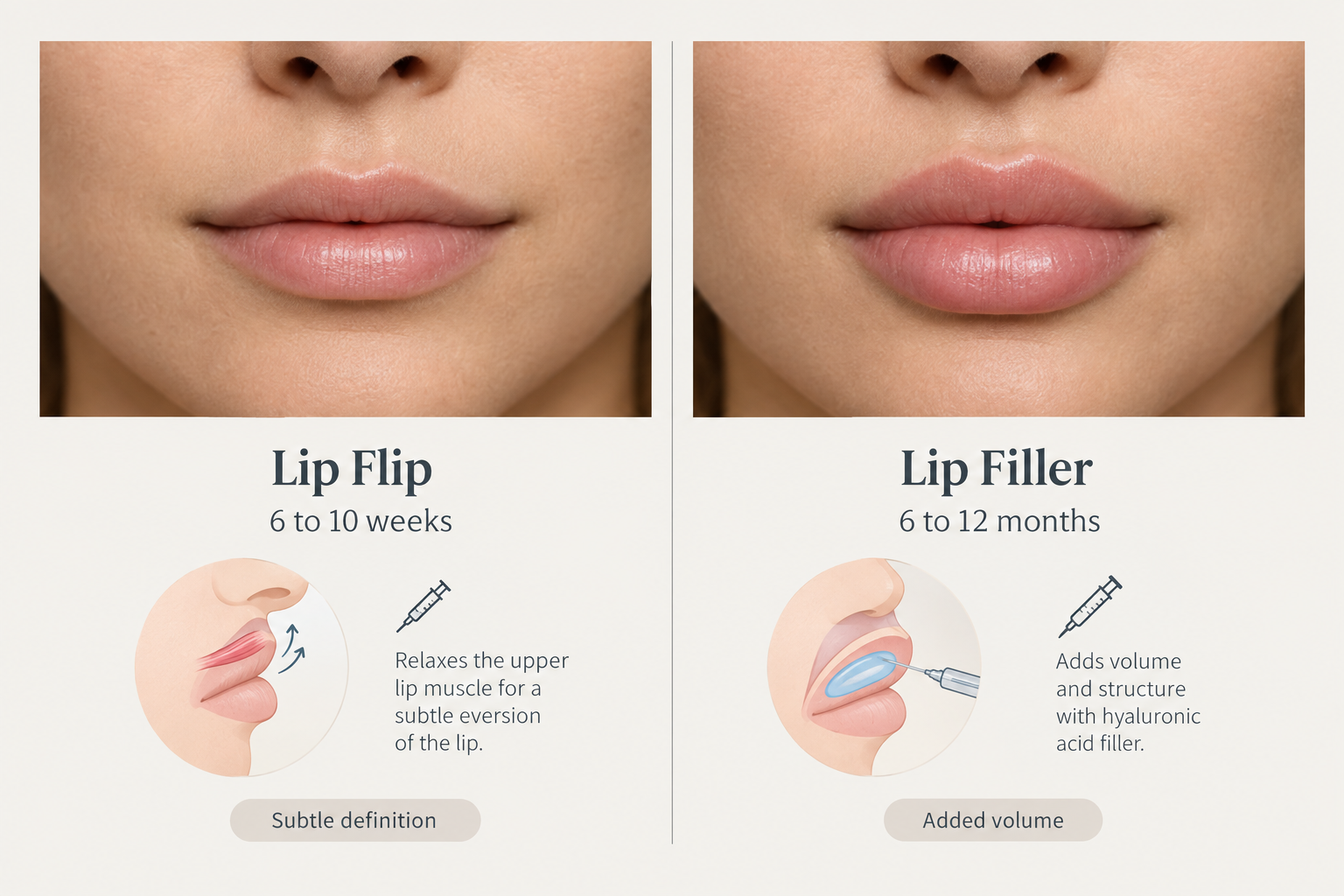 Comparison infographic showing lip flip versus lip filler results and duration